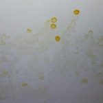 yellow drips on walls