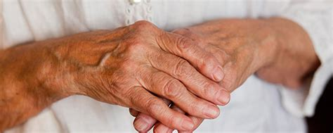 Coping With Arthritis